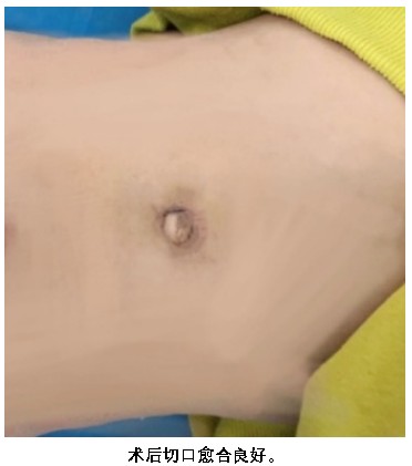 Snipaste_2024-11-21_08-13-09.jpg Snipaste_2024-11-21_08-13-09.jpg